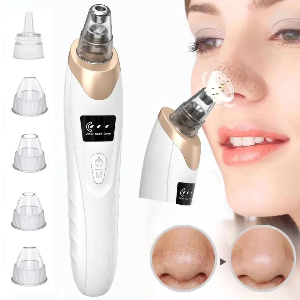 Electric Blackhead Acne Oil Remover Vacuum Suction