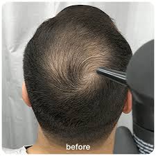 B-Fiber Hair Fiber | For Men & Women