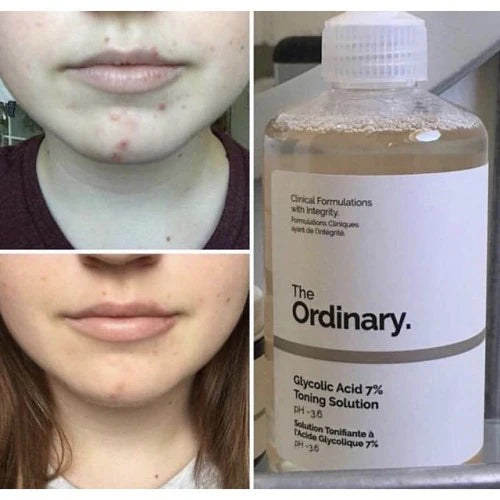 The Ordinary Glycolic Acid 7% Toning Solution - 240ML