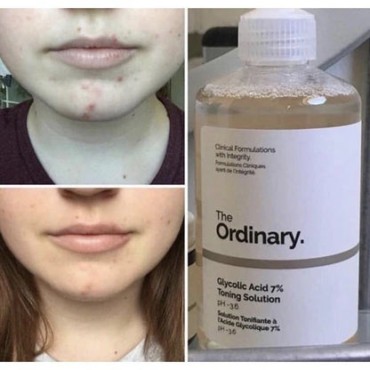 The Ordinary Glycolic Acid 7% Toning Solution - 240ML