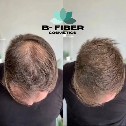 B-Fiber Hair Fiber | For Men & Women